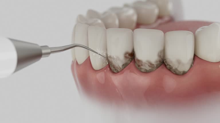 Trusted Invisalign Clear Aligners service in McMinnville, TN - Dentist Open Now